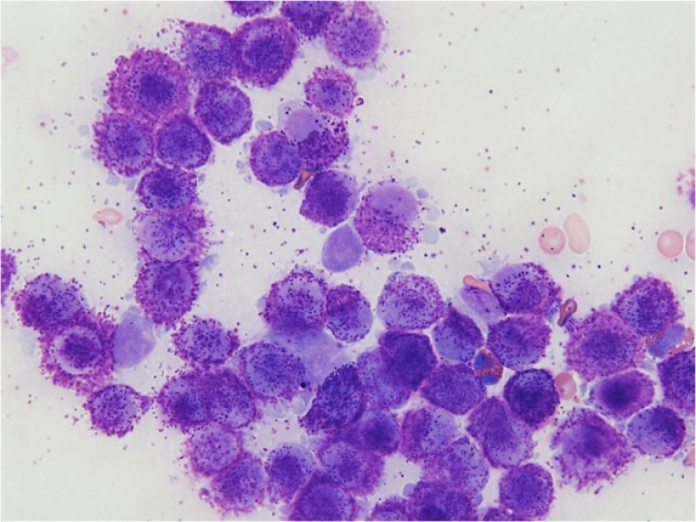 Mast Cell Tumor (Cancer)